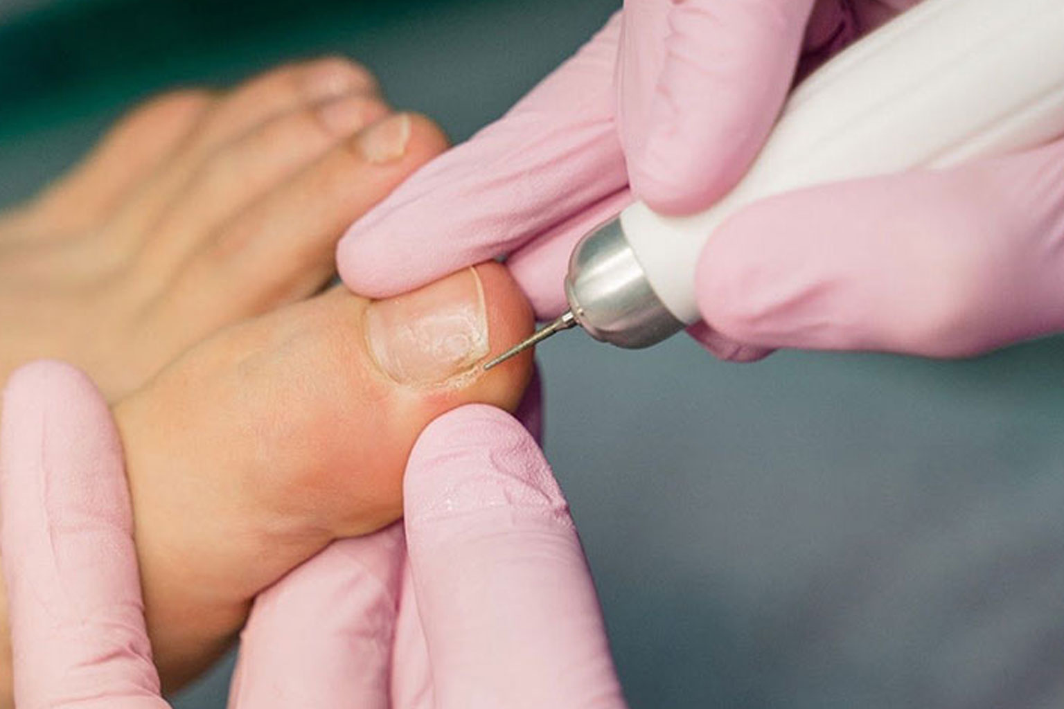 Cosmetic podology foot and nail treatment at PodoLogic Beauty